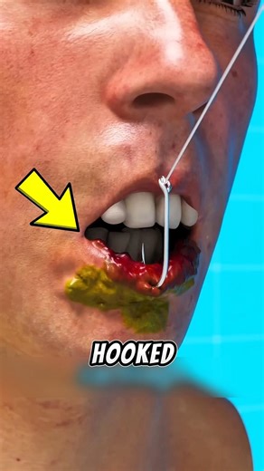 What REALLY Happens If You Get Stuck on a Fish Hook?‼️😱