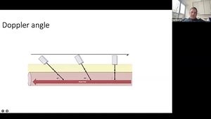 Basics of Carotid Ultrasound for Neurologists