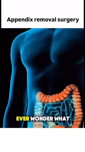 Animations on Instagram: "Follow @surgicalanimation for more! 🏥"