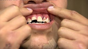 562K views · 1.1K reactions | Boxer Andres Gutierrez explains the...