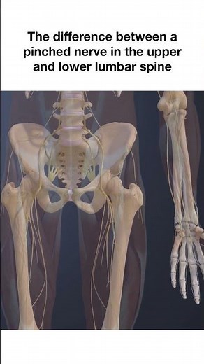 The Difference Between an Upper and Lower Lumbar Pinched Nerve