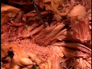 Anatomical dissection #14_ Deep neck