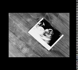 Emmerdale's Amy Walsh confirms second pregnancy with EastEnders star