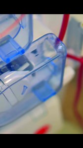 143K views · 1.6K reactions | AV fistula (arteriovenous fistula) explained for nursing school students, nurses, and more! #fistula #nursingschool #nurse #nurses #nursingstudent #healthcare #education #studygram #study | Registerednursern.com | Facebook