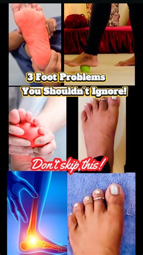 Foot Pain Relief Exercises! #shorts #trending #viral #youtubeshorts #ytshorts #exercise