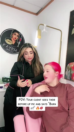 Transform Your Look: Lip Filler Before & After