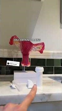 TL;DR BV treatment plans are not and should not be a one size fits all approach! #vagtok