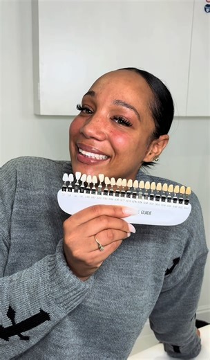 Teeth Whitening Training Day in Harrow