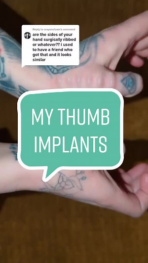 The Story Behind My Thumb Tattoos: Hand Implants and Body Mods