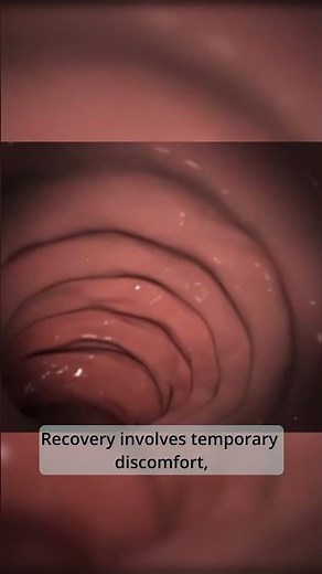 Navigating the Digestive Highway: A Peek Inside with Esophago-Gastro-Duodenoscopy.