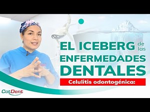 Celulitis Odontogénica - Iceberg de las enfermedades dentales