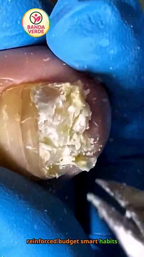 5.9K views · 58 reactions | Ep.451 Nail glow daily care + wearables guide heart-healthy meals in parks  #HeartStrong #Wellness #HealthyLiving | Banda Verde | Facebook