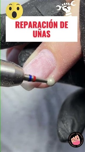 💅 Nail Repair with Acrygel! See How They Turn Out