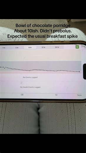 This is not normal for us. Her ratios haven’t changed. Could her pump be leaking extra insulin? Is she having a random honeymoon phase? So fed up and confused #type1diabetes #diabetes #type1diabetic