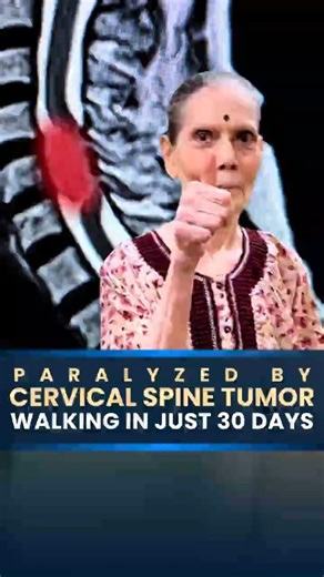 Spine Tumor Causing Paralysis | How Surgery Helped Her Walk Again