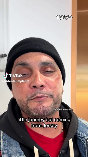 Six Months Post-Surgery Update on Dental Implants