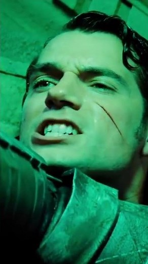 Why Kryptonite HURT Superman ?