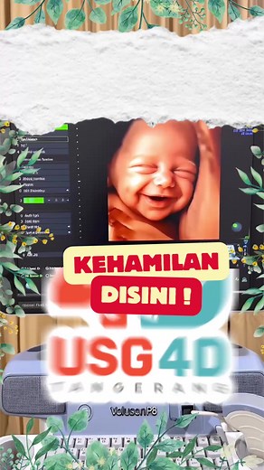 USG 4D Kehilangan di Tangerang: Diskon dan Manfaat