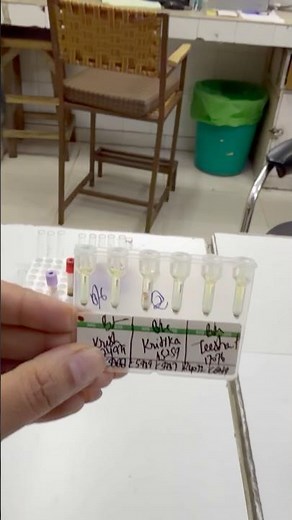 Gel Card Electrophoresis #blood #life #lablife #bloodgroup