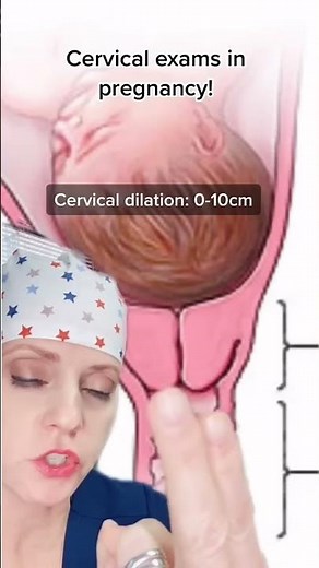 Cervical exams explained!