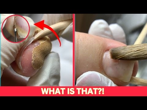 Most Satisfying Pedicure Transformation (Rain ASMR)