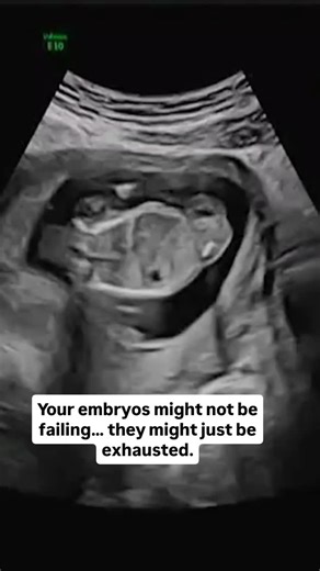 💫 IVF & Fertility Coach | Egg & Embryo Quality Specialist 🥚 on Instagram: "Most women think their embryos “aren’t strong enough.” But here’s the truth: Your embryos aren’t weak. They’re tired. Embryo development depends on mitochondrial energy — tiny batteries inside your eggs. If those batteries are low… the embryo can fertilise, divide… then stop. Day 3 arrest. Day 5 arrest. Failed implantation. Not because you’re broken. Because the embryo ran out of fuel. Nobody teaches you how to support 