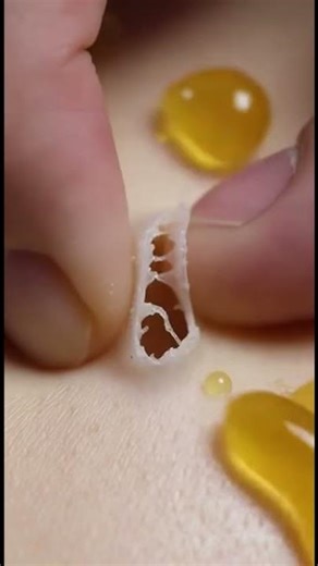 It’s gonna burst... it’s gonna burst... It BURST—!!! 💥