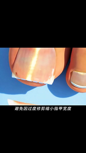 289K views · 2.5K reactions | 指甲的正确修剪方法你知道吗？ 很多人都剪错了一辈子！ #HealthTips #NailCare #指甲护理 #生活常识 #健康知识 | 用眼看世界 | Facebook