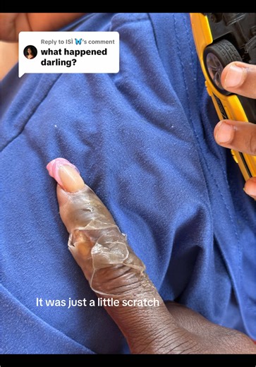 Healing from a Hand Injury: My Personal Journey