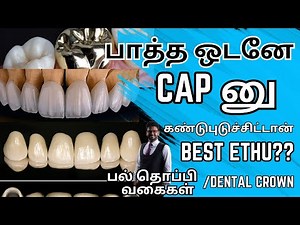 பல் தொப்பி வகைகள்/𝐃𝐞𝐧𝐭𝐚𝐥 𝐜𝐫𝐨𝐰𝐧 𝐭𝐲𝐩𝐞𝐬 𝐚𝐧𝐝 𝐜𝐨𝐬𝐭 𝐢𝐧 𝐭𝐚𝐦𝐢𝐥/Best dental crown for front teeth in tamil