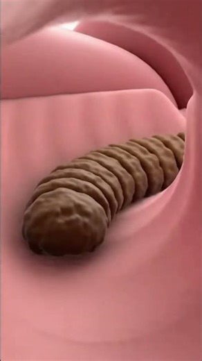 What REALLY Happens Inside Your Colon #anatomy