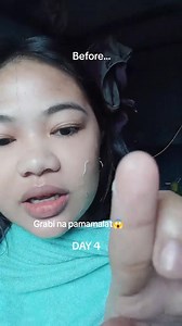 the JOURNEY of using BEAUTY VAULT PREMIUM REJUVENATING SET ‼️ 💯 LEGIT TALAGA! order na sa link nasa comment section lang 🥰 #BeautyVaultPremiumRejuvenatingSet #BeautyVaultRejuvenatingSet #BeautyVaultPremium #highlightseveryone #Rejuvenating #skincareroutine #BeautyVault #followers #fypviralシ | Beauty Vault Rejuvenating Set