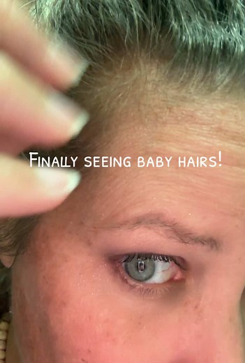 Lustriva for Stronger, Thicker Hair Growth