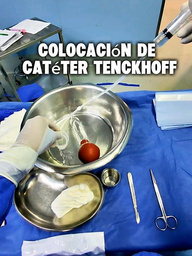 Colocación de catéter Tenckhoff para diálisis peritoneal