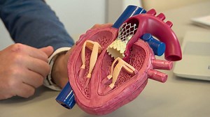 TAVI – Ein schonender Eingriff bei Herzpatienten