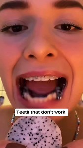 744K views · 5.8K reactions | Western dental care throws chemicals and dental visits on the first sign of issue. But it rarely fixes the root cause: bacterial imbalance, weak enamel, and toxic habits. The miswak, used for thousands of years, strengthens and whitens naturally treating the cause. #cavities #toothbrush #teethwhitening | Healthy living | Facebook