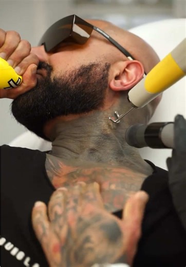 Transforming Strength: Removing a Black-Out Tattoo