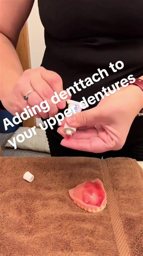 Applying Denttach to Upper Dentures: Step-by-Step Guide