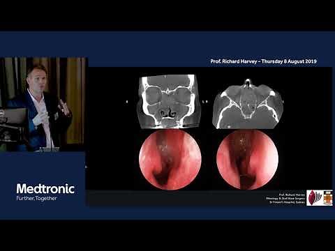 Understanding Inflammatory sinus disease, nasal polyps and chronic sinusitis - Prof Richard Harvey