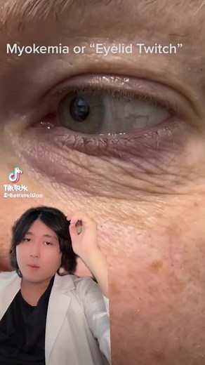目の下のピクピクに関する医者の解説