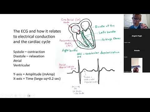 2023 16 How to read a paediatric ECG