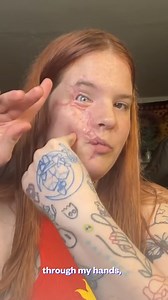 415K views · 5.6K reactions | He Attacked Me Unprovoked - My Survival Story - Full story is available on page. #survivor #lifestory #victim | Miracle Survivors | Facebook