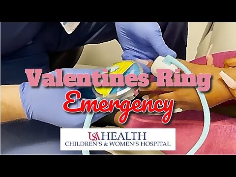 A Stuck Valentines Ring Emergency