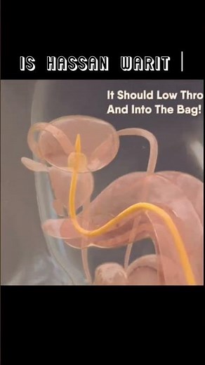 how to pass catheter in Male patient insert procedure#nursing #anatomy #fandamental