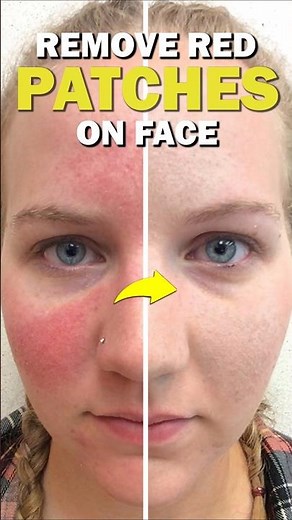 Remove Redness from Face in Photoshop 2025 – Quick Skin Fix! #ducthangds #missperfectdesigner