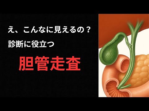 【エコー検査】胆管走査の基本を完全解説！走査手順をエコー画像でわかりやすく解説
