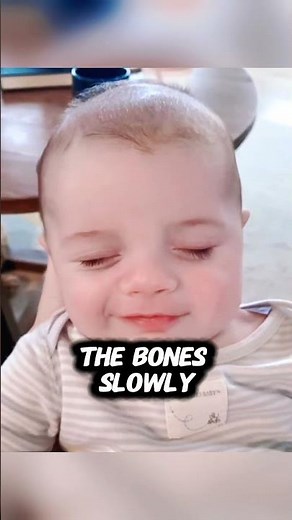 Why You Shouldn’t Touch a Baby’s Skull