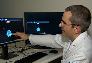 Programa de computador pode acelerar diagnóstico de AVC - SBT News