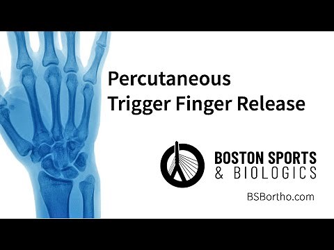 Trigger Finger Treatment: Minimally Invasive Ultrasound-Guided Release vs. Traditional Surgery