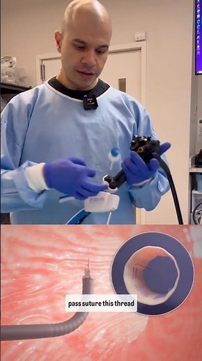 Tools and Techniques Used to Perform an Endoscopic Sleeve Gastroplasty (ESG)